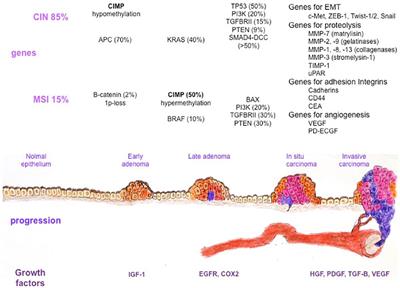 Colonic Cancer and Acromegaly